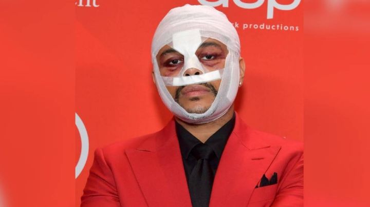 ¡Qué horror! Internautas reaccionan al aspecto de The Weeknd y hacen memes sobre eso