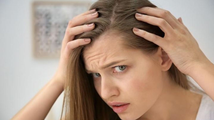 Este es el mejor remedio casero para acabar con el terrible hongo de la caspa