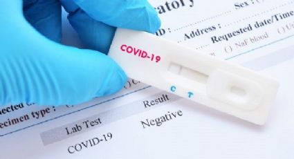 Científicos desarrollan prueba que detecta qué tan graves serán síntomas en enfermos por Covid-19