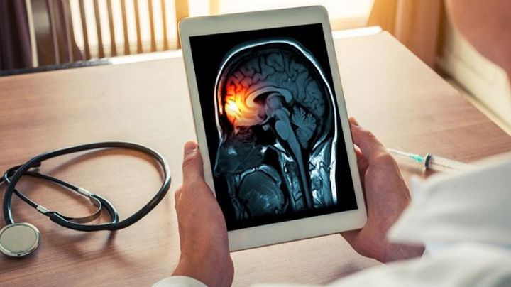 ¿Qué es la meningitis, cuáles son sus síntomas, causas, síntomas y cómo se contagia?