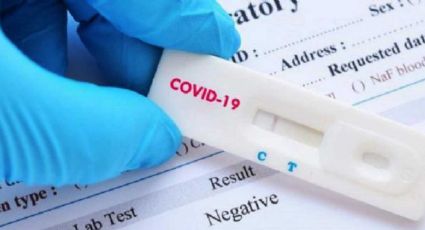 Coronavirus: Crean nueva prueba para Covid-19 que da resultados en 2 hroas