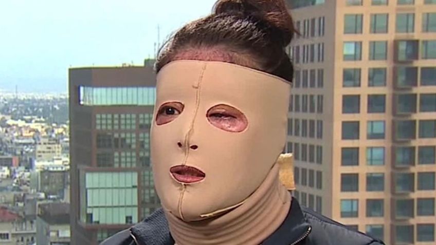 María Elena Ríos: Detienen al exdiputado implicado en el ataque con ácido