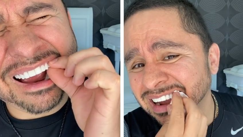 VIDEO: A falta de dentista, Larry Hernández se repara diente con pegamento