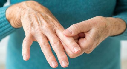 ¿Sufre artritis reumatoide? Estos alimentos podrían ayudan a combatir el dolor