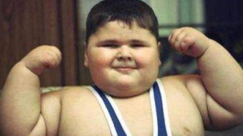 Muere a los 21 años el joven quien fue considerado "El niño con más peso del mundo"