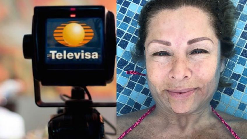 Sin exclusividad y tras casi morir, actriz de Televisa se somete a cirugía y acaba ¿desfigurada?