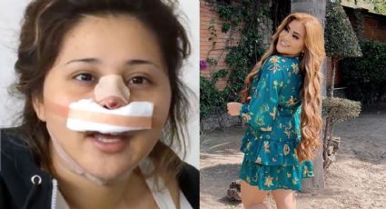 'Gomita' reaparece tras nueva operación y deja en shock a Instagram: "Lo naca no se le quita"