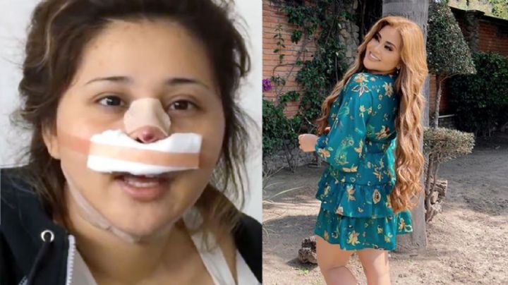 'Gomita' reaparece tras nueva operación y deja en shock a Instagram: "Lo naca no se le quita"