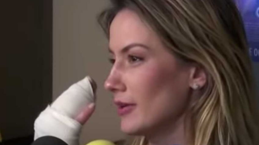 "Quedó hecha papilla": Con la mano vendada es captada Altair Jarabo tras sufrir fuerte accidente