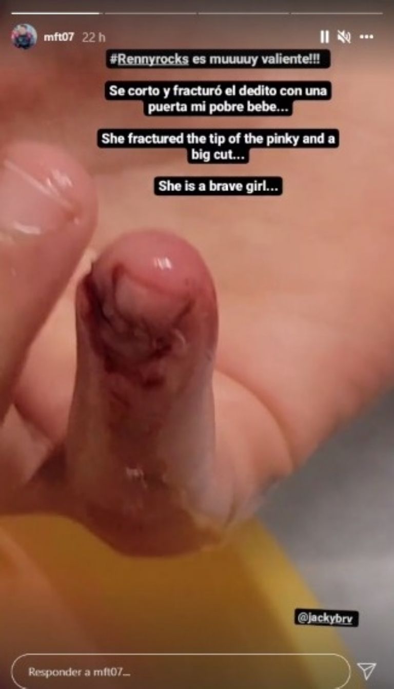 Hija de Jacky Bracamontes sufre accidente