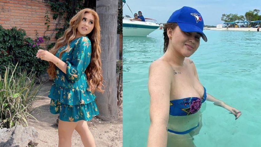 'Gomita' presume su figura tras reciente cirugía y deja en shock a Instagram: "Tiene mucho relleno"