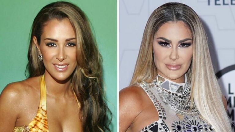 Ninel Conde, antes y después
