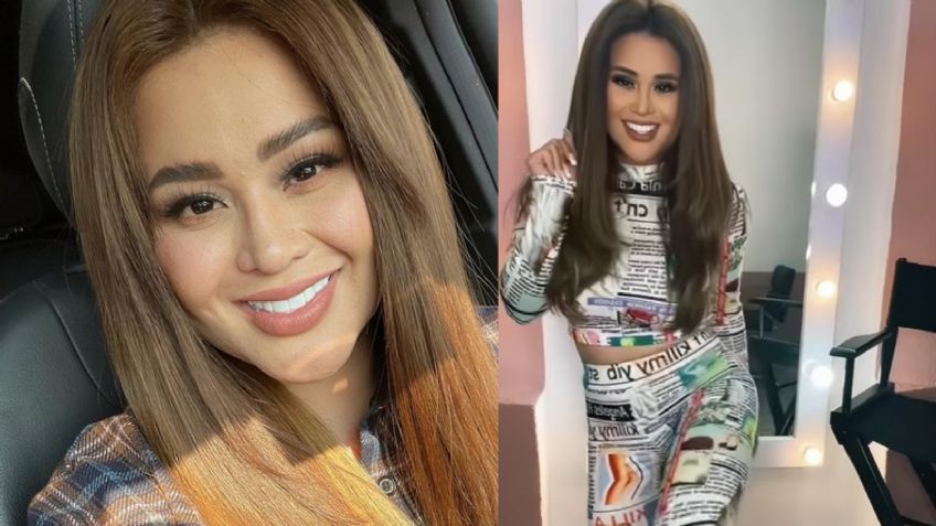 "Recomienda al cirujano": 'Gomita' luce brutal cambio tras nueva cirugía y la destrozan en Instagram