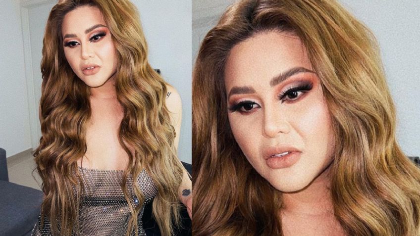 "Más cara que cuerpo": 'Gomita' luce los resultados de nueva cirugía y deja en shock a Instagram