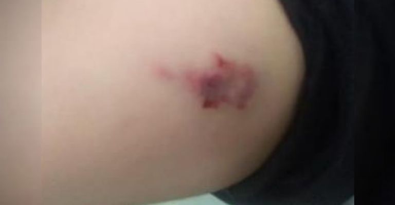 Joven ataca a mordidas a policías de Nuevo León