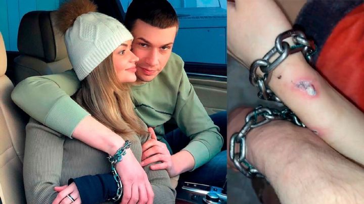 ¡De locos! Novios se encadenan para estar pegados 3 meses y terminan con úlceras en la piel