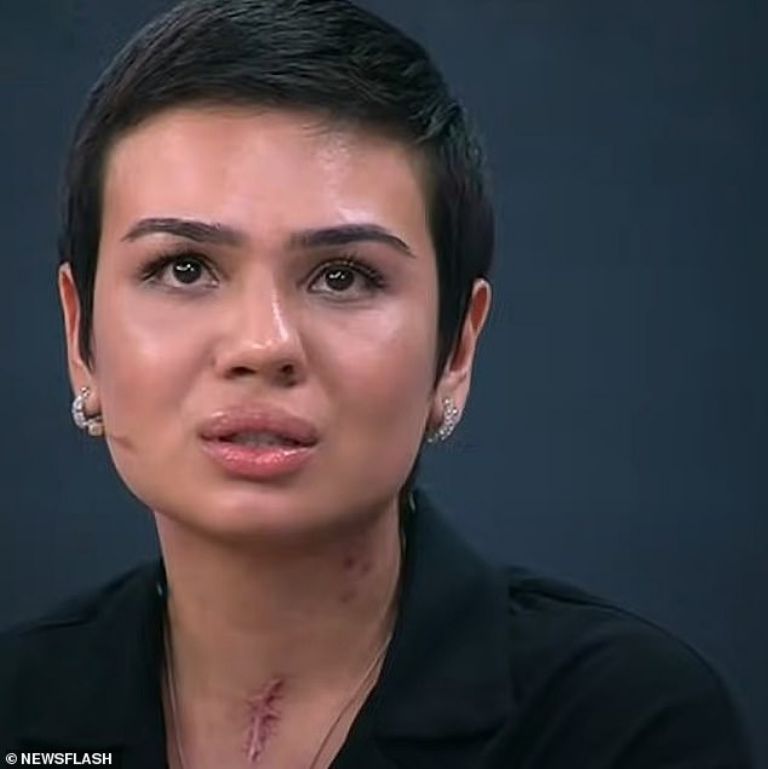 Karolina Sarkisyan casi pierde la vida por una cirugía de nariz