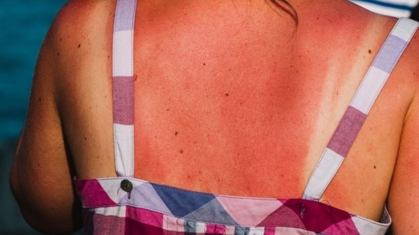 Conoce todo sobre el cáncer de piel y protégete durante esta primavera para evitarlo