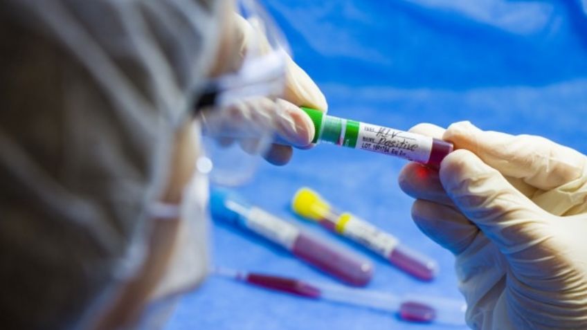 ¡Asombroso! México participará en el ensayo clínico para la vacuna contra el VIH