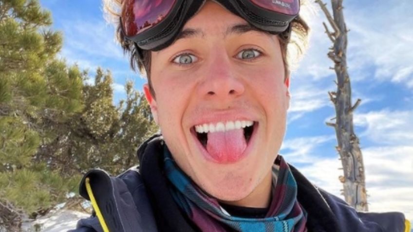 ¡Se quema el rostro! Juanpa Zurita comparte cómo se ve su rostro luego de quemarse con el frío