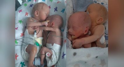 Milagro en hospital: Gemelos prematuros se abrazan; pensaban que un bebé no sobreviviría