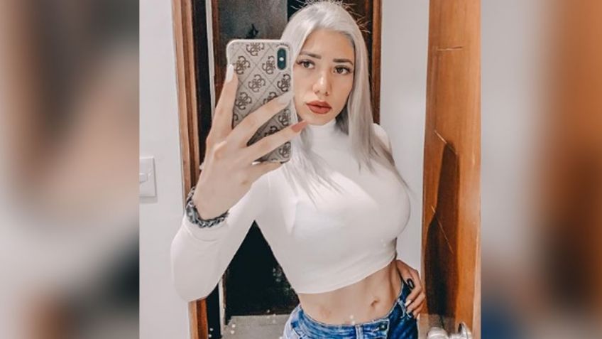 ¿Y esos moretes? Exparticipante de 'Enamorándonos' alarma por raras marcas en su piel