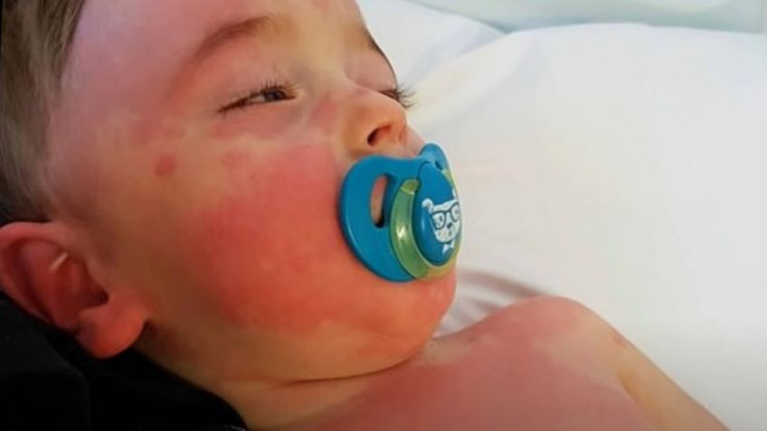 ¡Alerta! Detectan este peligroso síndrome en niños y jóvenes que padecieron Covid-19