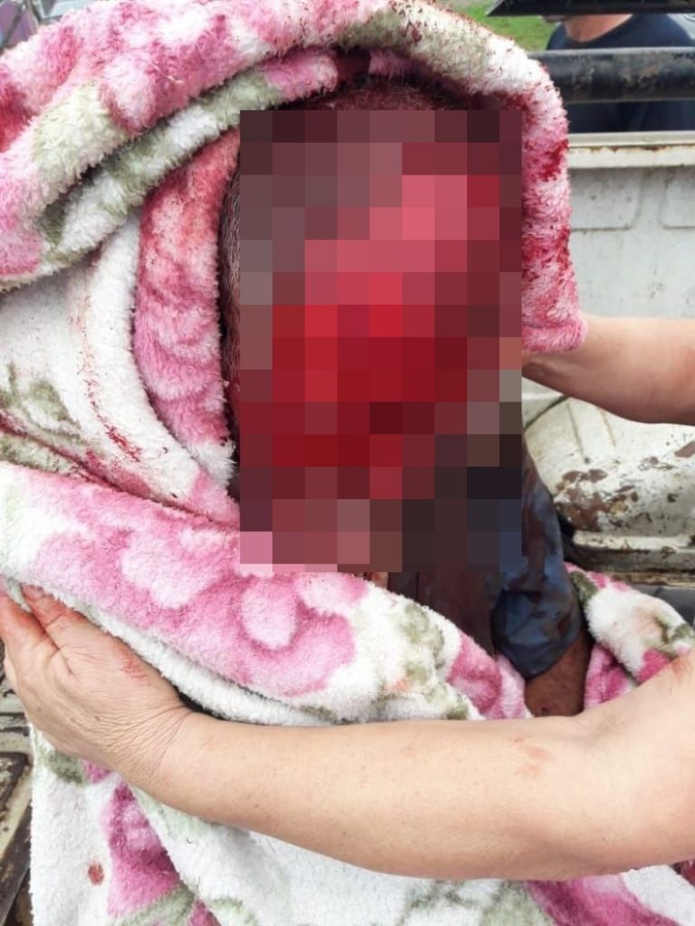 Siete perros asesinan a un hombre y le devoran la cara