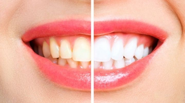 Luce una sonrisa de comercial al eliminar estos alimentos que manchan tus dientes