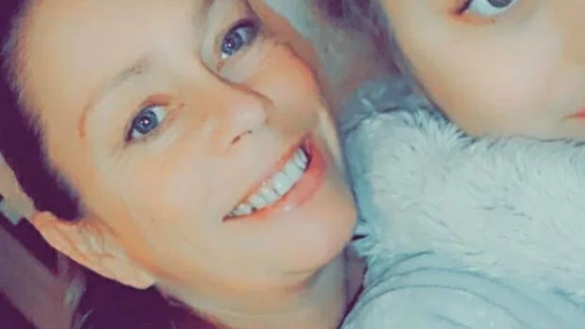 FOTOS: Estos son los fuertes síntomas que sufrió Susie por la vacuna AstraZeneca contra Covid-19