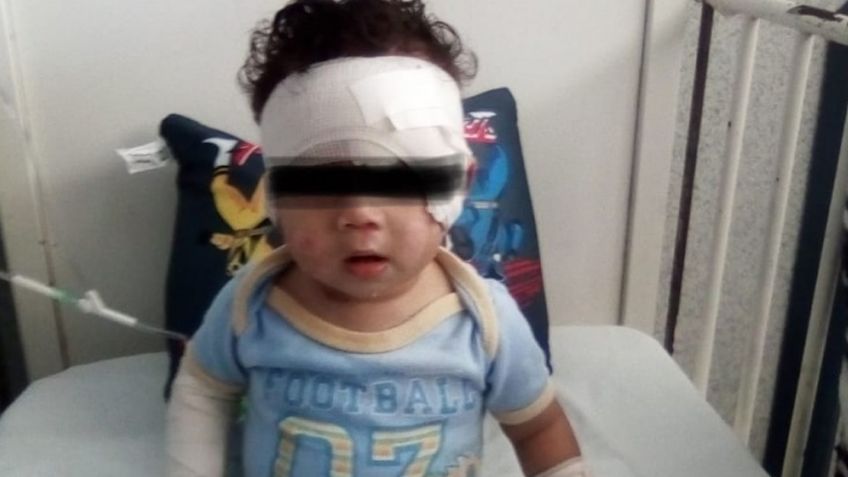 Bebé de 8 meses sufre severas quemaduras en Hermosillo; le cayó una olla de agua caliente