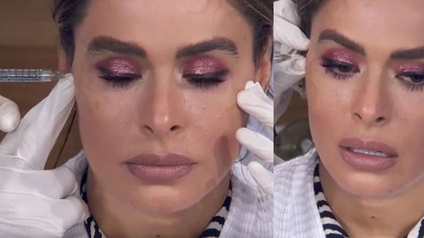 "La están desfigurando": Se comen viva a Galilea Montijo por inyectarse "vitaminas" en la cara