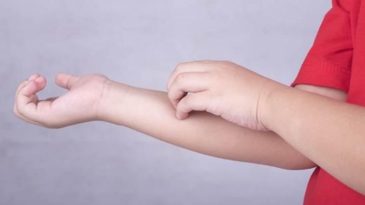 "Tenía carne colgando": Padre salva a su hijo de ser devorado por un perro; destrozó su brazo