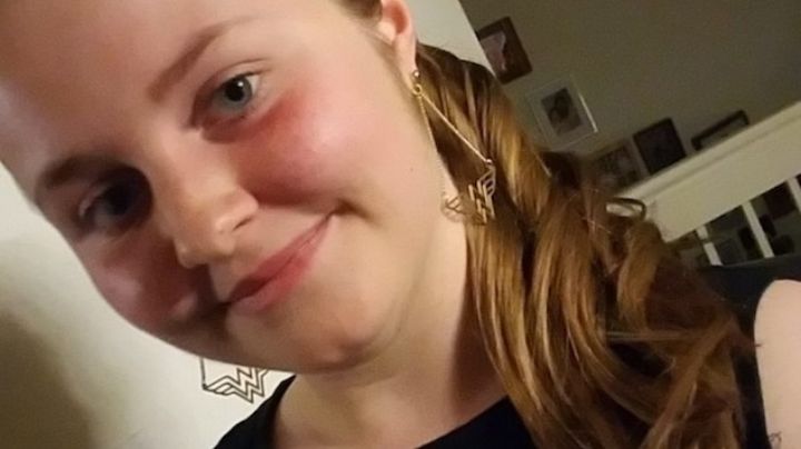 Joven de 18 años termina en coma y con tres cirugías cerebrales tras recibir esta vacuna