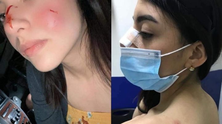 FOTOS: Mujer defiende al asesino de 'Rodolfo Corazón'; dijo que el perro inició la agresión