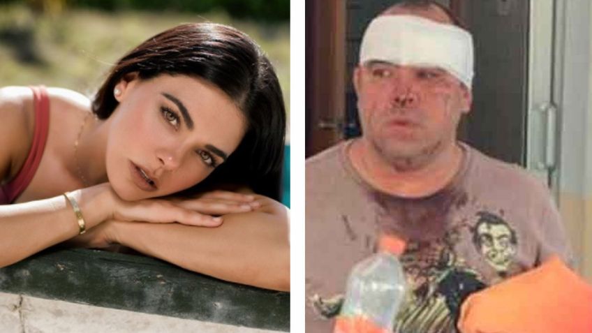 Polémica en Televisa: Livia Brito denuncia a fotógrafo al que propinó golpiza; lo acusa de esto