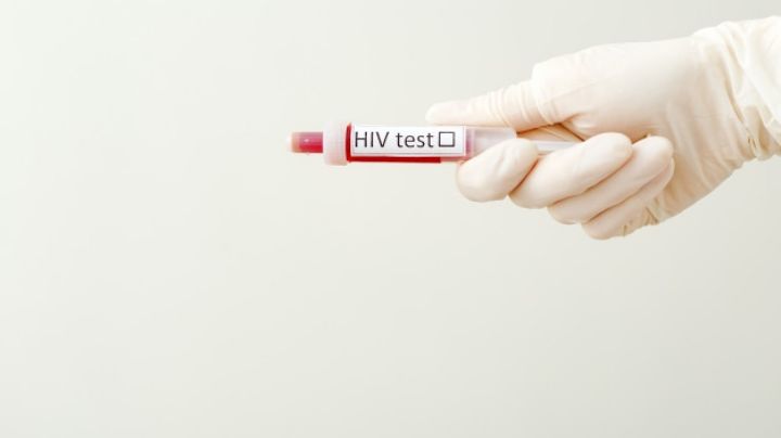 Buenas noticias: La esperanza de vida de personas con VIH ha aumentado