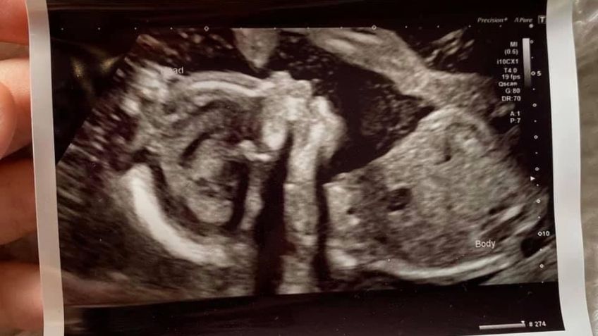 "No podemos hacer nada": Madre ve cómo parteras dejan morir a su bebé prematuro