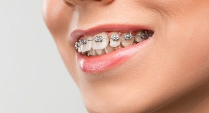 Ten una sonrisa de envidia al cuidar correctamente tu ortodoncia durante el confinamiento