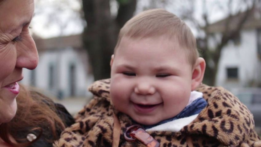 ¡Aterrador! Descubre qué es la microcefalia y por qué es peligrosa para los recién nacidos