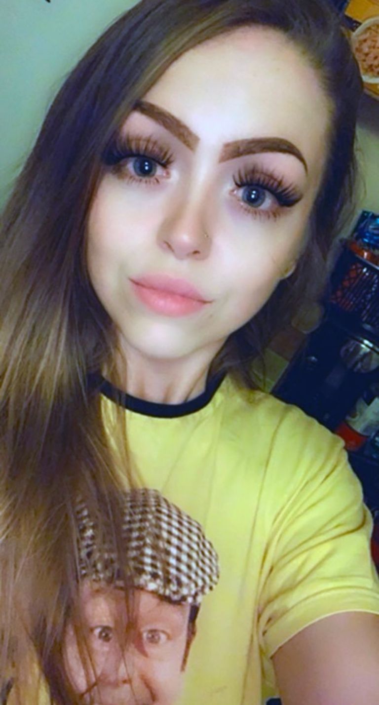 Lauren Briggs perdió una pierna