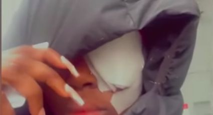 VIDEO: ¡Lamentable! Cargador explota en el ojo de una joven y casi pierde la vista