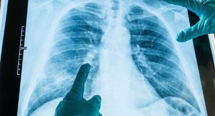 ¡Buenas noticias! Los pulmones también pueden generar anticuerpos contra el coronavirus