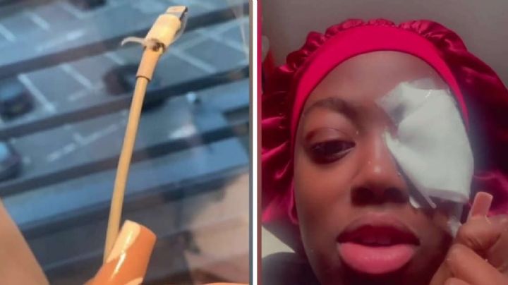 Joven queda parcialmente ciega luego de que le explotara un cargador de iPhone en la cara