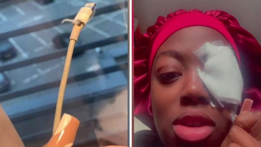 Joven queda parcialmente ciega luego de que le explotara un cargador de iPhone en la cara