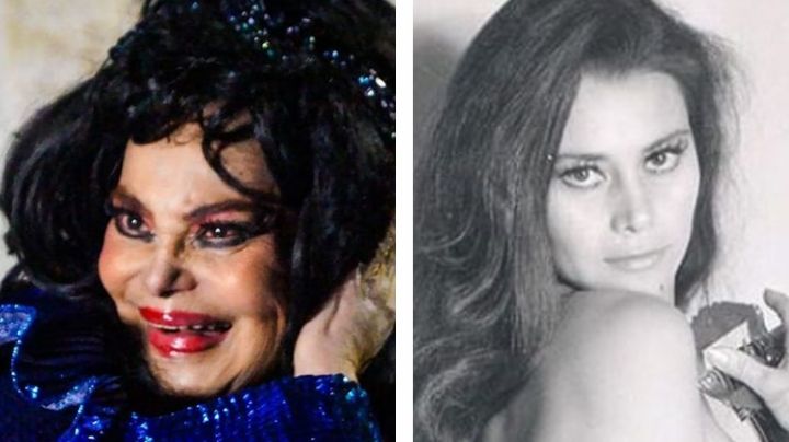 Tras 'desfigurarse' con cirugías, actriz de Televisa y TV Azteca vuelve con trágica noticia: "Me muero"