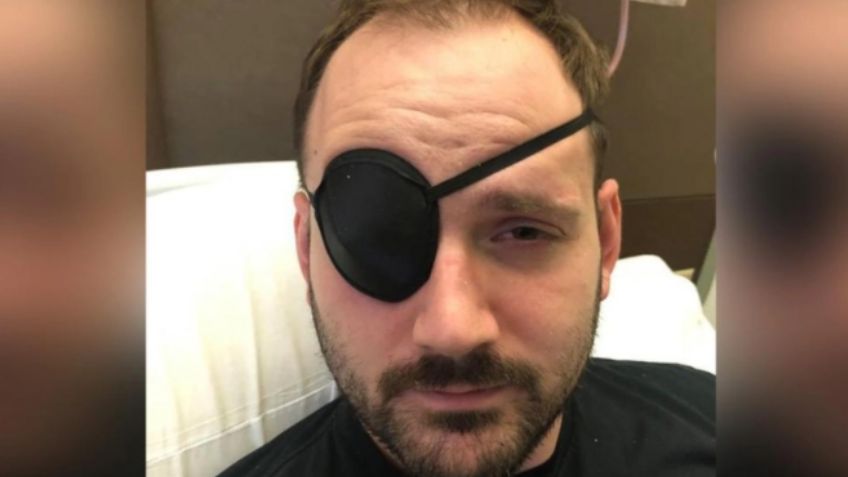 ¡Cuidado! Hombre se "truena" el cuello y sufre derrame cerebral: "Se desgarró las arterias"