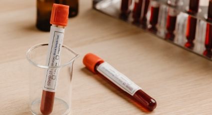 Científicos españoles crean nueva prueba para detectar anticuerpos del coronavirus