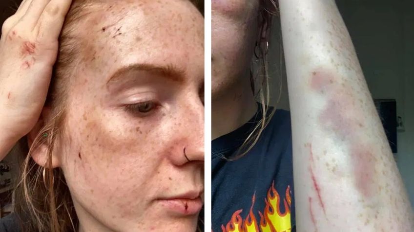 FUERTES IMÁGENES: Grupo de hombres agarran a joven y la torturan; corría en el parque