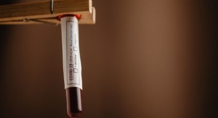 Científicos aseguran que la sangre podría predecir el riesgo de muerte por Covid-19